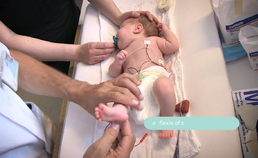 Neurologisch onderzoek bij premature geboorte
