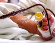 Bloedtransfusies bij pasgeborenen